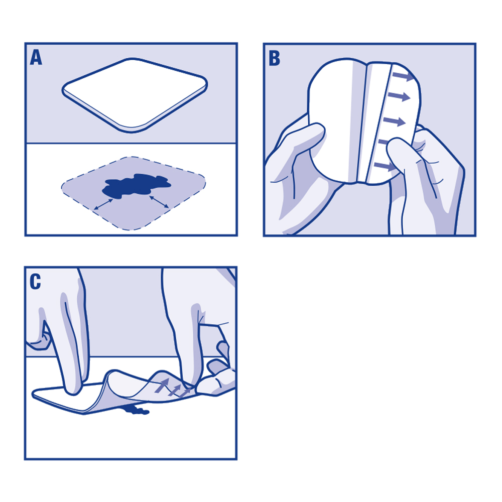 Image showing how to apply Cutimed® Hydro B and Cutimed® Hydro L Image showing how to apply Cutimed® Hydro B and Cutimed® Hydro L